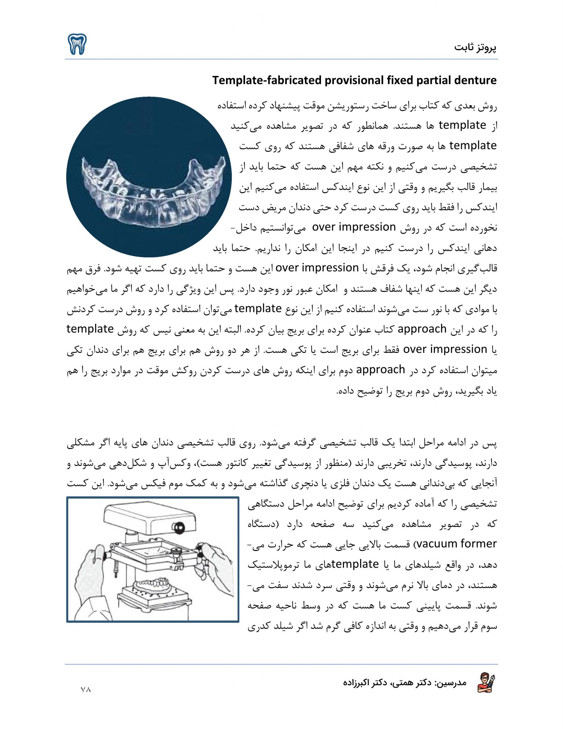 پروتز
