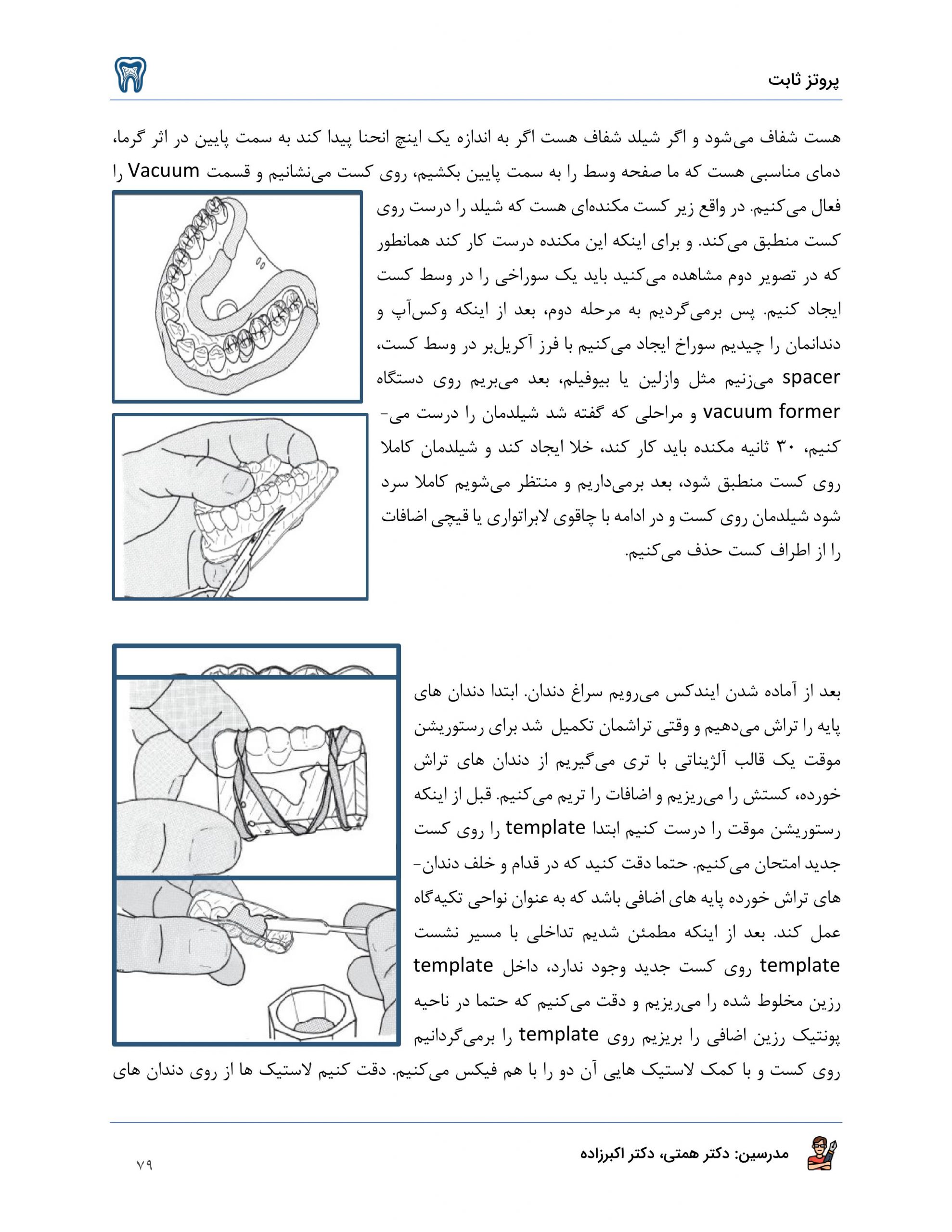 جزوه پروتز