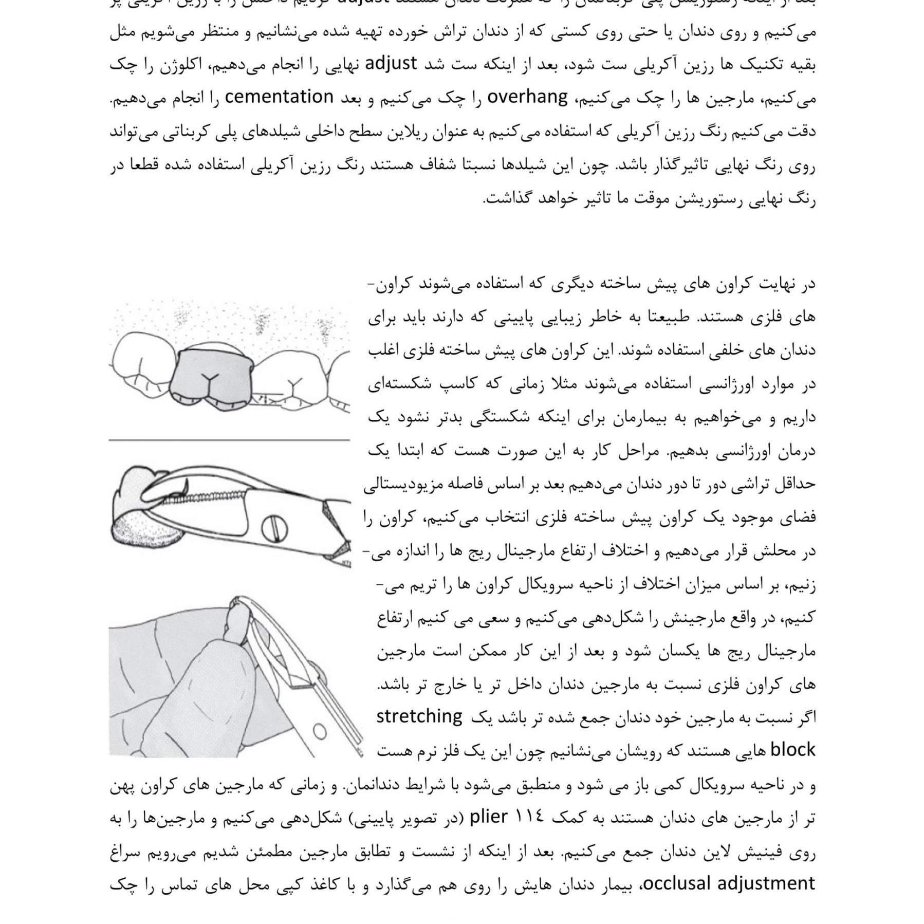 جزوه پروتز دندانپزشکی